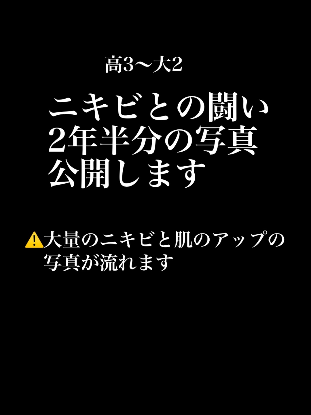 🚨4日連続ニキビ関連投稿します🚨

まずは1日目、9歳の頃から現在もニキビに悩んでいる私ですが、今までで1番ニキビが酷かった時期の肌状態を公開します。

次回以降には、この期間中に試したもの、学んだことなど投稿していけたらと思います。
