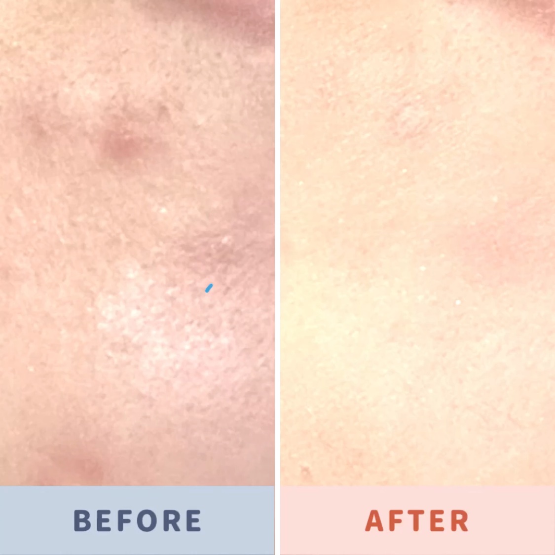 カバーアッププロコンシーラー/TFIT/パレットコンシーラーを使ったクチコミ（2枚目）