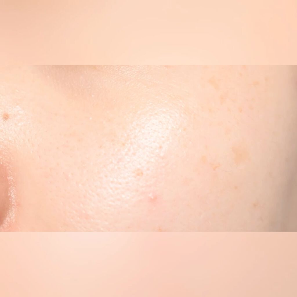 ピンクティーツリーカバークッション/APLIN/クッションファンデーションを使ったクチコミ（2枚目）