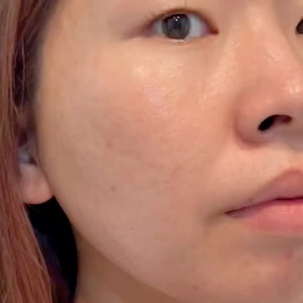 ベターツリカン肌荒れ美容液/Mildlab/美容液を使ったクチコミ(5枚目)