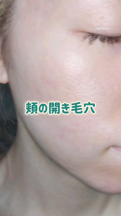 -`📢⋆ あらゆる悩みにこのセラム🍀

┈┈┈┈┈┈┈┈┈┈

ホルモンバランスの乱れや、
マスクによる肌荒れ……
生理前のニキビや皮脂トラブル

無限に出てくる山のような肌悩み😭

原因はある程度わかっていても、
正直どのようなケア