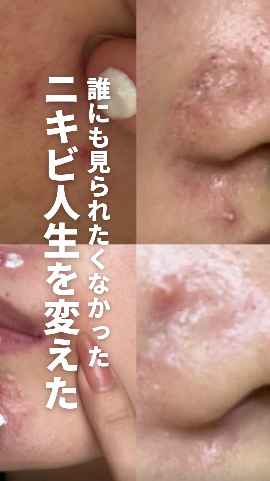 .
やっぱりやっぱりFATIONだよね！
ということで、私の思いをこの動画に詰め込みました🥹✨
.
もうセットが良すぎて！！！
これはお得すぎない？！🥹🥹
先着ギフトもあるし、何よりもお得すぎる値段、、　
.
これはみんなゲットするし