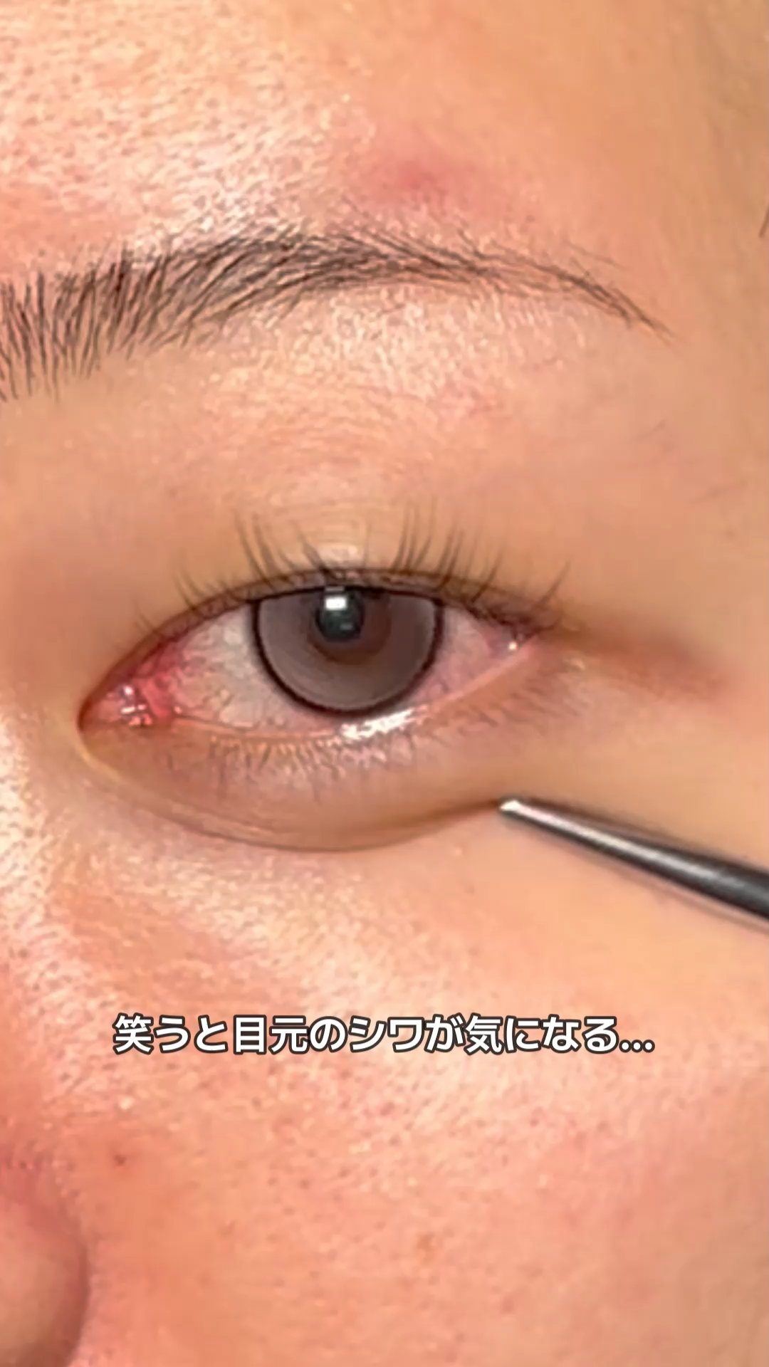 カルノシン リフティング セラム ルフティグ/ODELOI/美容液を使ったクチコミ（1枚目）