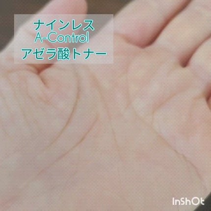 A-Control 10%アゼライックアシッドセラム/NINELESS/美容液を使ったクチコミ(5枚目)