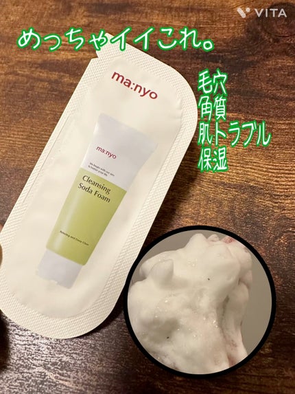 ソーダ洗顔料/manyo/洗顔フォームを使ったクチコミ(1枚目)