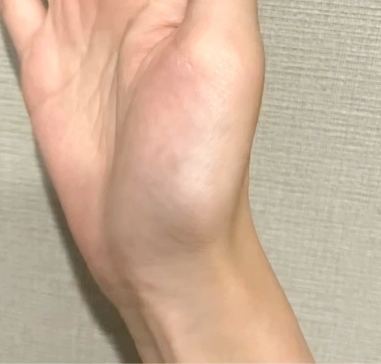 薬用デイエッセンスバーム/TIME SECRET/美容液を使ったクチコミ（3枚目）