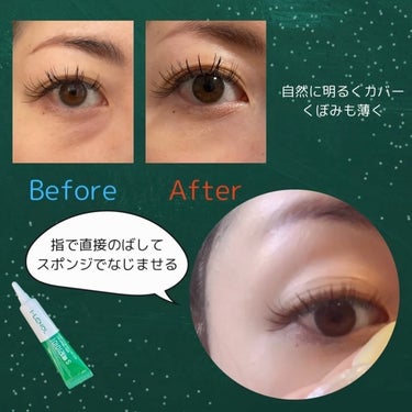 クマカバーアイクリーム/Eyelenol/アイケア・アイクリームを使ったクチコミ（3枚目）