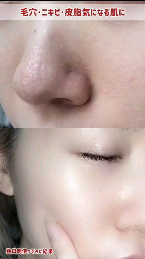 AZケア クレンジングオイル/VT/オイルクレンジングの人気ショート動画