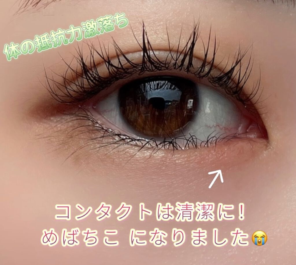 めばちこになりました😭

こんにちは🙋💕Riaです


めばちこになりました
東日本では ものもらい というそう

正式名は麦粒腫 です


細菌感染でおきるみたいですが

身体の抵抗力が下がっていたり
不潔な手で目を触ったり
コンタ