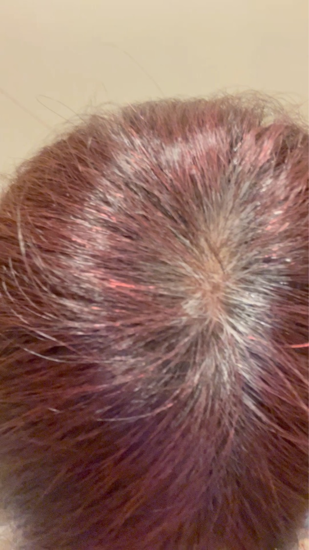 クリアリーカラー (白髪用)  ペールピンク/クレオディーテ/ヘアカラーを使ったクチコミ（2枚目）