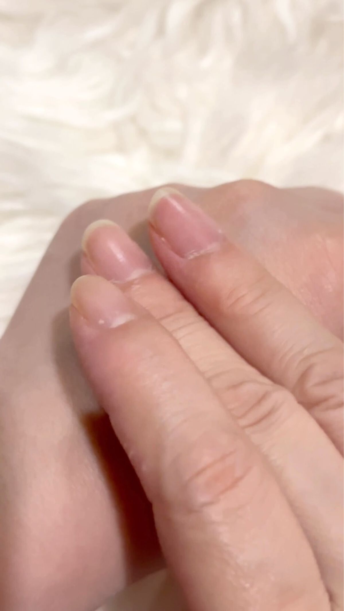 美白乃美人ピーリングジェル/ブレーンコスモス/ピーリングを使ったクチコミ（3枚目）