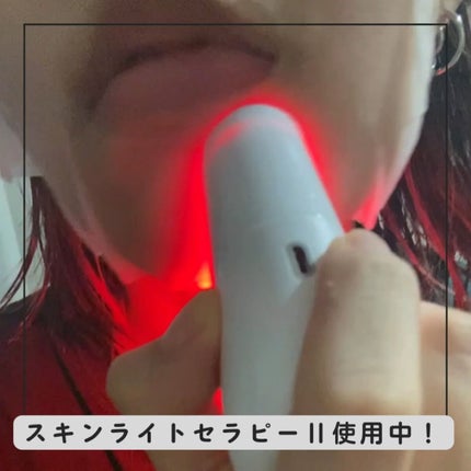 スキンライトセラピーII/Makeon/美顔器・マッサージを使ったクチコミ(3枚目)