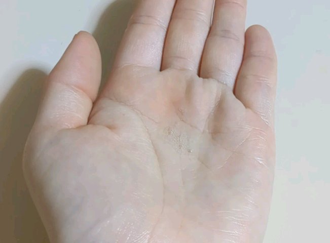 エイクリアリングアクティブパンテノール3％フェイシャルセラム/MEDITHERAPY/美容液の動画クチコミ5つ目