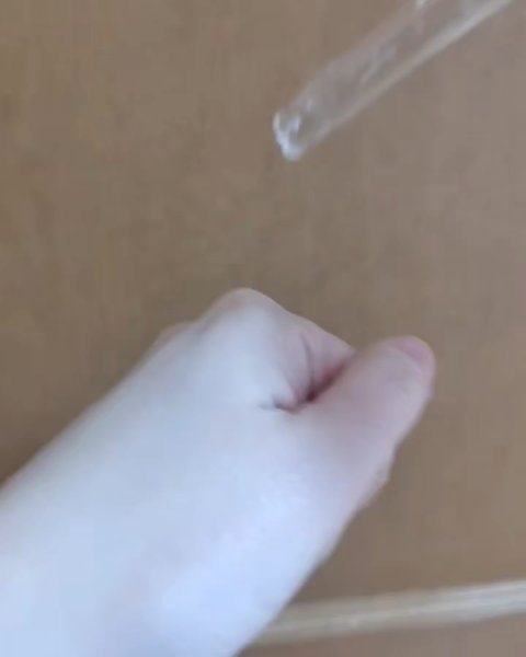 アネトス アクネケア トリートメント セラム/Anetos/美容液を使ったクチコミ（2枚目）