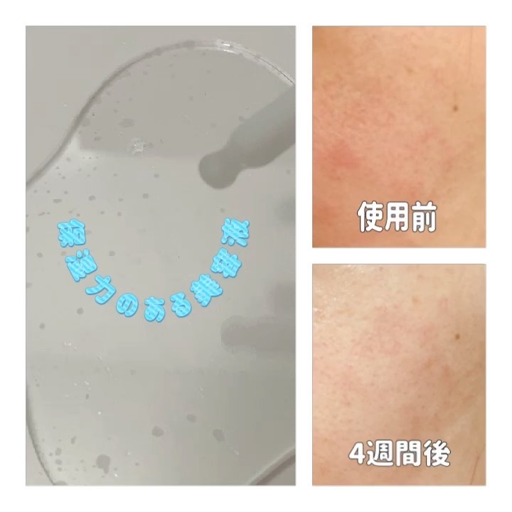 ライトアクティブアンプル/P.CALM/美容液の動画クチコミ3つ目