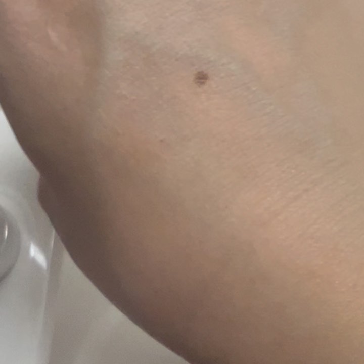 リードルショット300/VT/美容液を使ったクチコミ（3枚目）