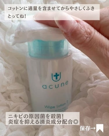 アキュネ 薬用ふきとりローションT/アキュネ/拭き取り化粧水を使ったクチコミ（4枚目）