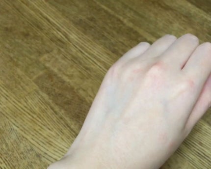 グリーンダーマCICAセラム/ネイチャーリパブリック/美容液を使ったクチコミ(3枚目)