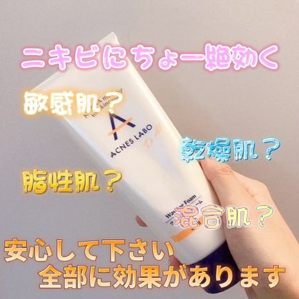 薬用ニキビケア ウォッシングフォーム(思春期用)/アクネスラボ/洗顔フォームを使ったクチコミ(1枚目)