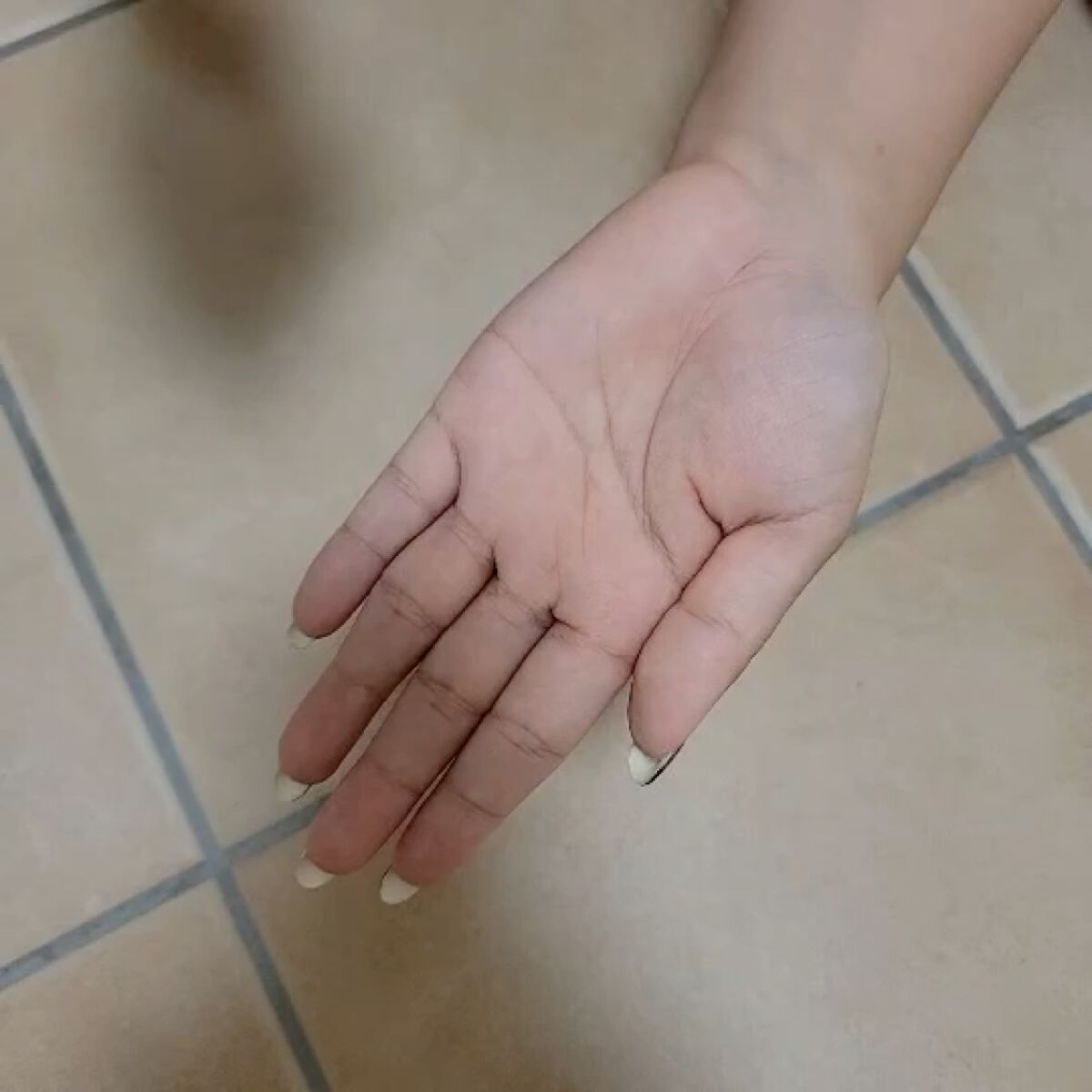 Baby Pore Air Pad/SUPRARX/その他スキンケアを使ったクチコミ（3枚目）