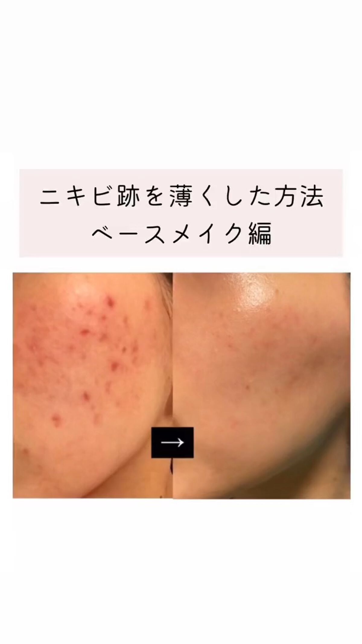 マットスムースミネラルファンデーション/エトヴォス/パウダーファンデーションの動画クチコミ4つ目