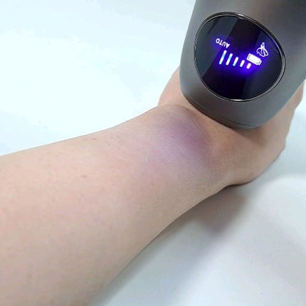 試してみた】Noend コードレス脱毛器のリアルな口コミ・レビュー 試してみた】Noend コードレス脱毛器のリアルな口コミ・レビュー
