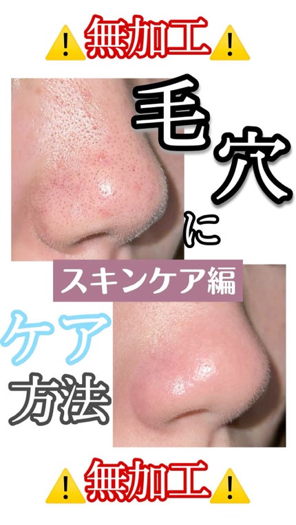 グリーン ダーマCICAビックトナー/ネイチャーリパブリック/化粧水の人気ショート動画