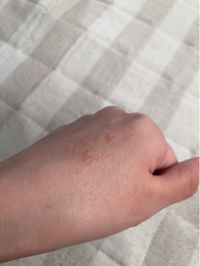 リップ スクラブシャス/M・A・C/リップスクラブを使ったクチコミ(3枚目)