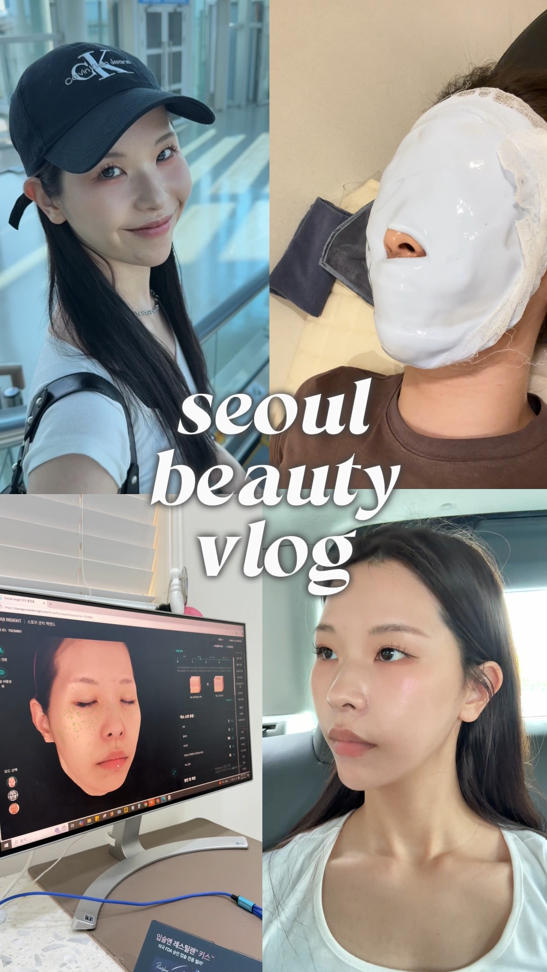 🇰🇷 day 2 *全て自費施術です○

前回の肌管理もあわせて
4件のクリニックを紹介🪄

リジュラン/サーモン注射は睡眠麻酔です😴

次回はニキビ跡と
テカリを抑える施術を受けてみる✍️

#韓国旅行 #韓国クリニック #美容皮