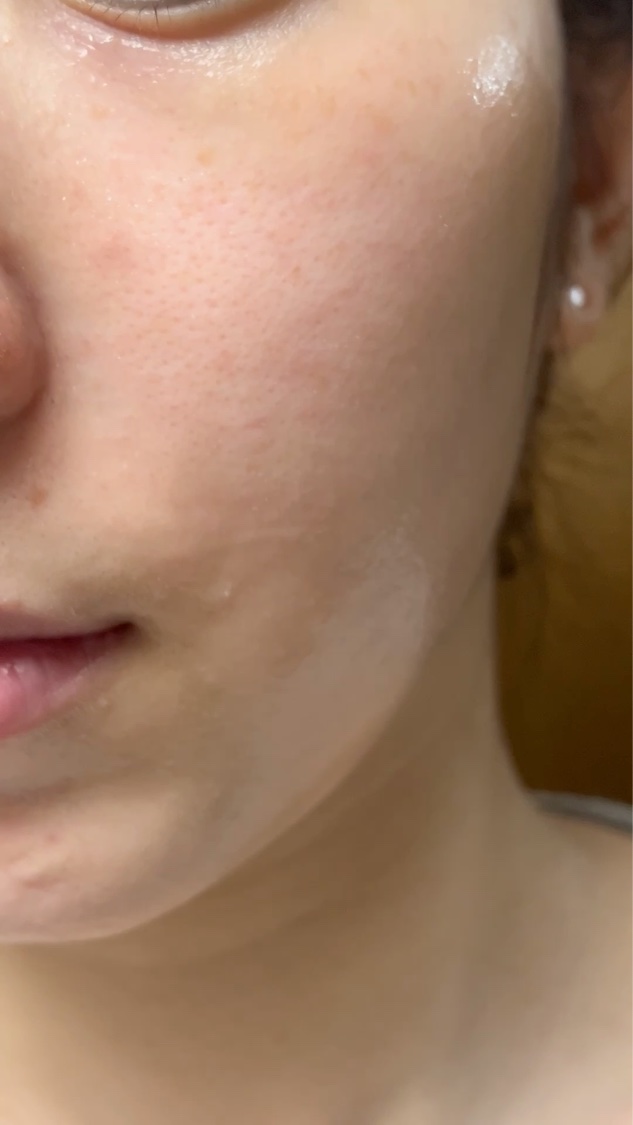 プロバイオダーム99.9 メルティングコラーゲン笑い皺&頬フィルム/BIOHEAL BOH/シートマスク・パックの動画クチコミ1つ目