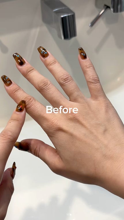 リポピールセラム/LIPOPEEL/美容液の人気ショート動画