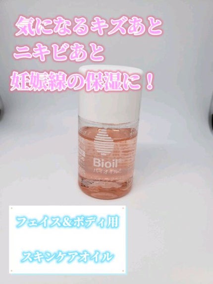 バイオイル/バイオイル/フェイスオイルを使ったクチコミ(1枚目)