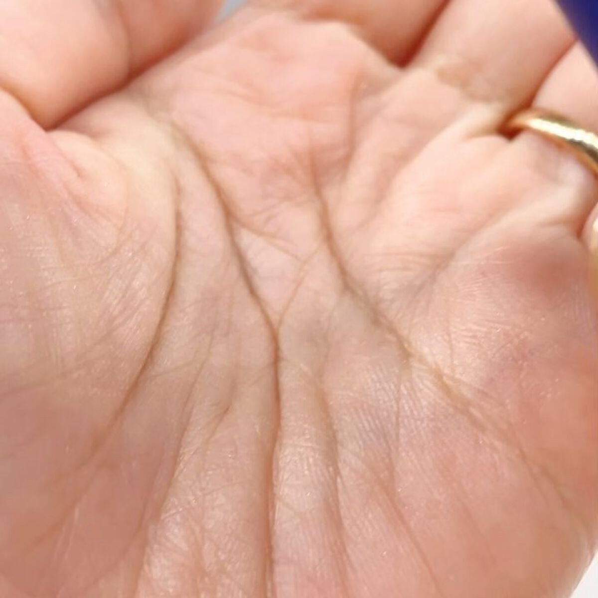 セラMD　リペアローション/Derma:B/ボディローションを使ったクチコミ（3枚目）