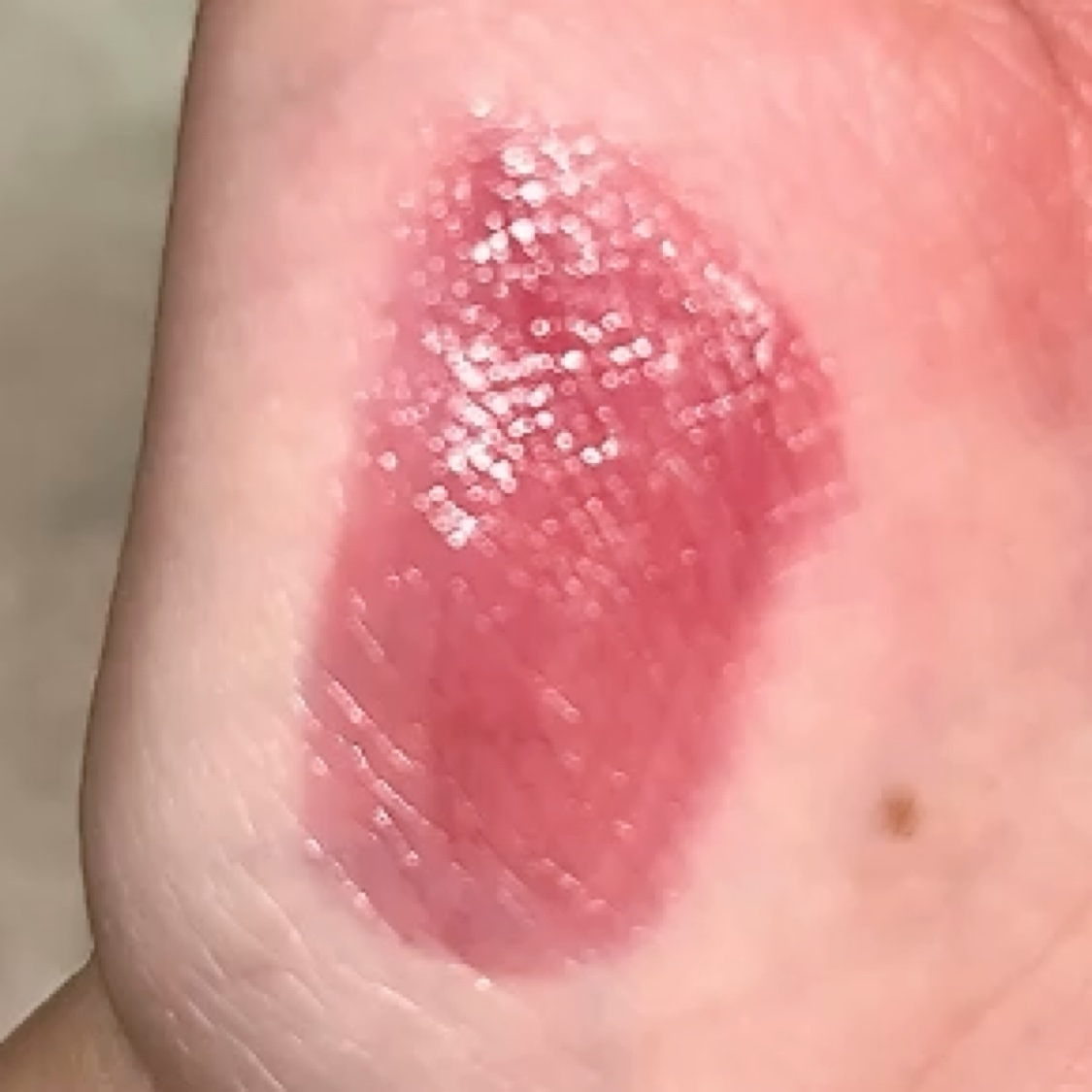 フルーティーグラムティント/Laka/リップティントを使ったクチコミ（3枚目）