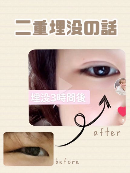 アイトーク/アイトーク/二重まぶた用アイテムを使ったクチコミ(1枚目)