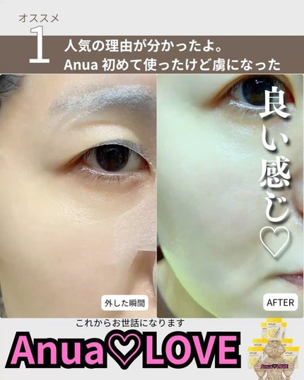 ロングラスティングチップコンシーラー/LUNA/リキッドコンシーラーを使ったクチコミ(4枚目)