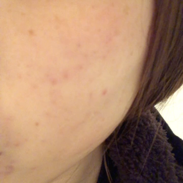 クリアトライアルセット M（しっとりタイプ）/オルビス/トライアルキットを使ったクチコミ（2枚目）