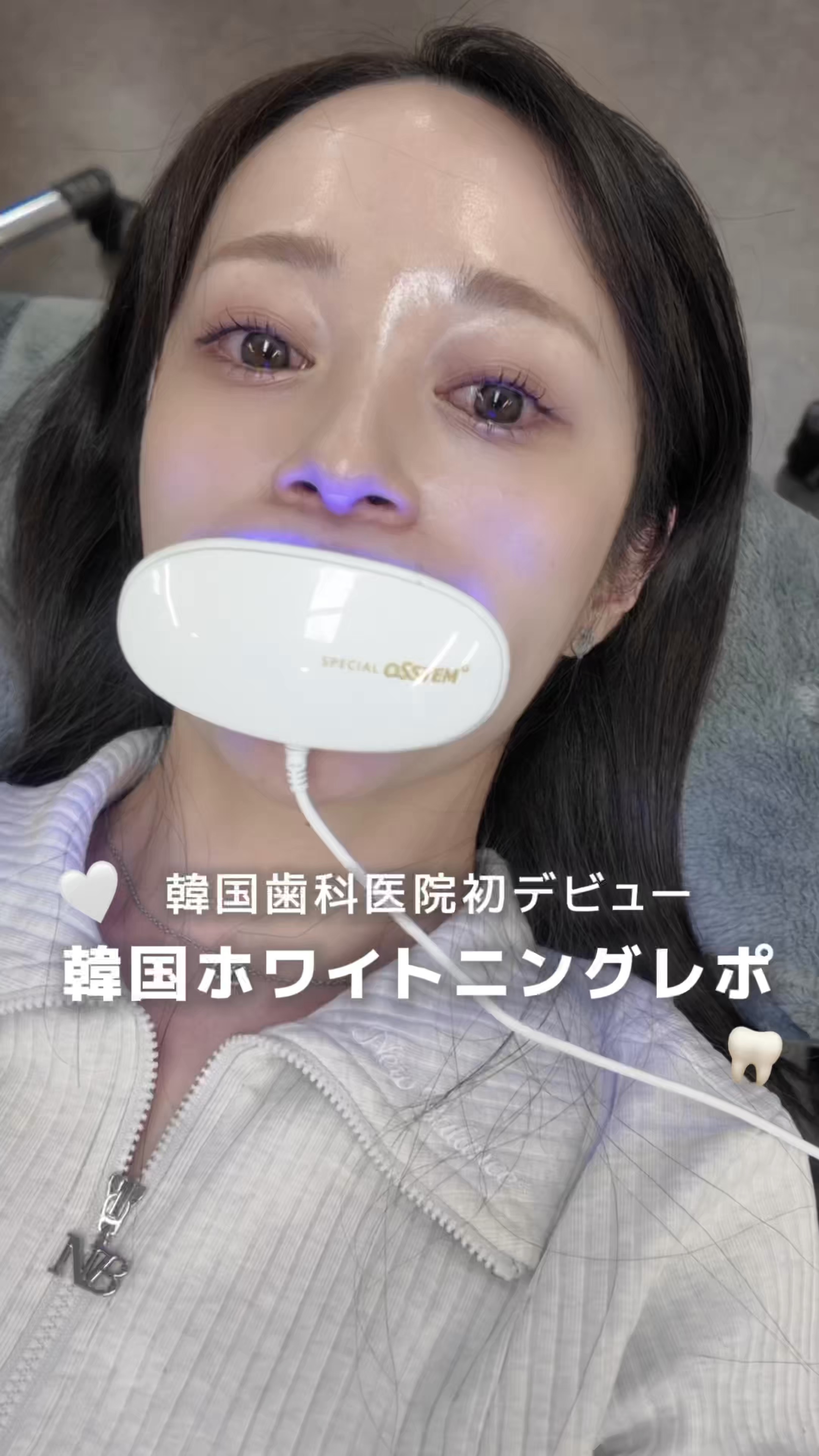 \韓国歯科医院デビュー🦷/
韓国ホワイトニングレポ

歯の黄ばみが気になるので韓国でホワイトニングをしてきました❕

今回ホワイトニングしてきたのは江南のオンジュ駅2番出口目の前にあるデンティーク歯科🦷

韓国の歯医者さんは初めてだった