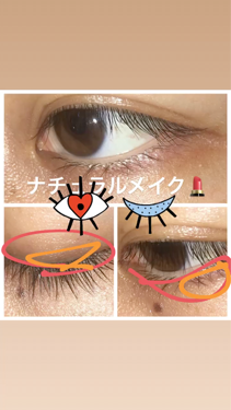 ローヤルゼリー配合 栄養ローション/DAISO/美容液を使ったクチコミ（1枚目）