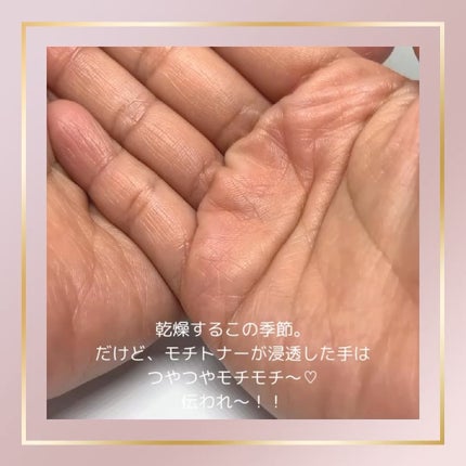 Wonder Ceramide Mochi Toner(トニーモリーワンダーCモチトナー)/TONYMOLY/化粧水を使ったクチコミ(7枚目)