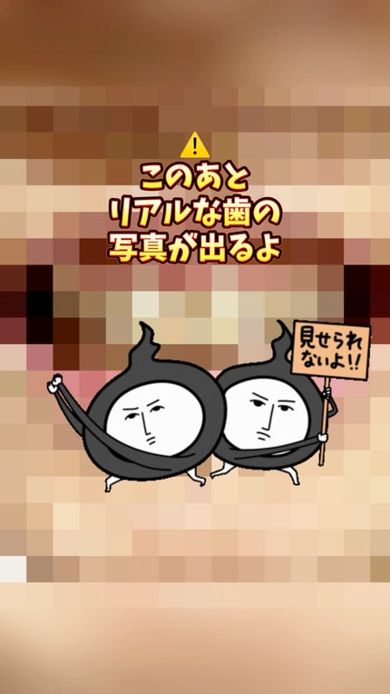 歯磨き堂 薬用ホワイトニングペースト プレミアム/歯磨き堂/歯磨き粉の人気ショート動画