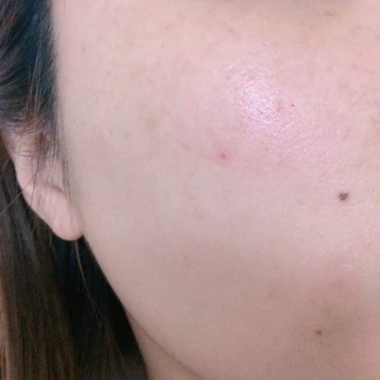 ダイヤスピテラアンプル/NUDIQUE/美容液の動画クチコミ4つ目