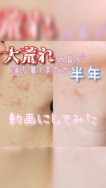 ボディタオル アワスター RNアワスター/キクロン/バスグッズの動画クチコミ2つ目