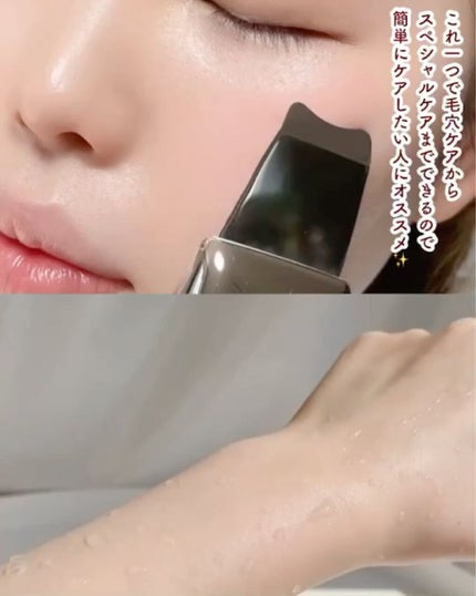 アクアリフトピーリング/roserine Dr.'s esthetics/美顔器・マッサージを使ったクチコミ(8枚目)