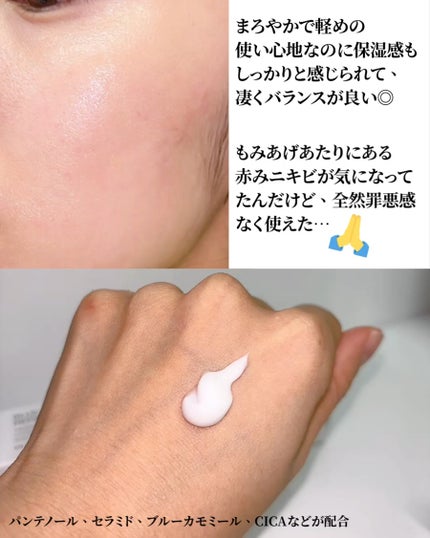 ブルーセンテラ デルマリペアクリーム/Mildlab/フェイスクリームを使ったクチコミ(6枚目)