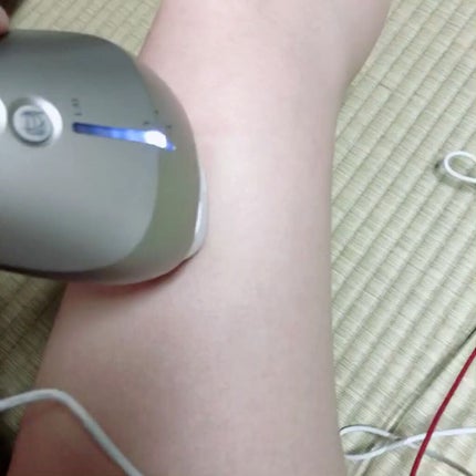 試してみた】光美容器 光エステ ボディ&フェイス用 ハイパワー 試してみた】光美容器 光エステ ボディ&フェイス用 ハイパワー