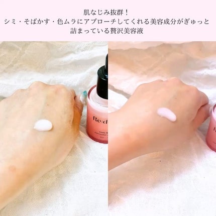 リデンス チェリートーン&スポットコレクターアンプル/redence/美容液を使ったクチコミ(2枚目)