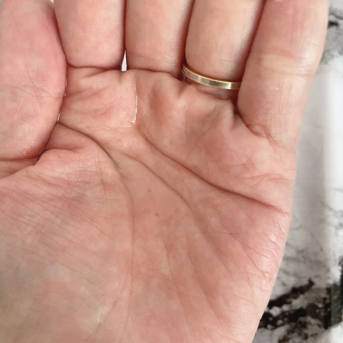 アクネケア ジェル乳液　＜医薬部外品＞/ファンケル/乳液を使ったクチコミ（3枚目）