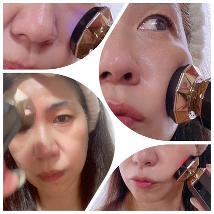 試してみた】ANLAN RF温冷美顔器PROのリアルな口コミ・レビュー 試してみた】ANLAN RF温冷美顔器PROのリアルな口コミ・レビュー