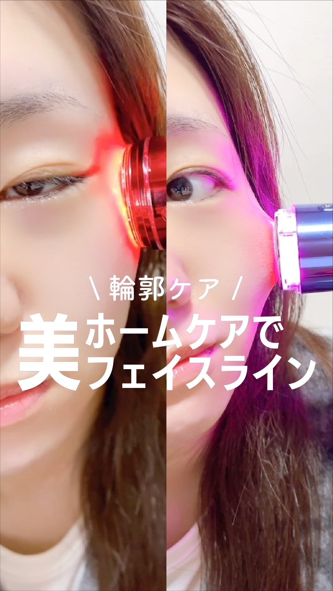 シューマジゴールド糸リフティングクリーム+EMS美顔器/MEDITHERAPY/フェイスクリームの人気ショート動画